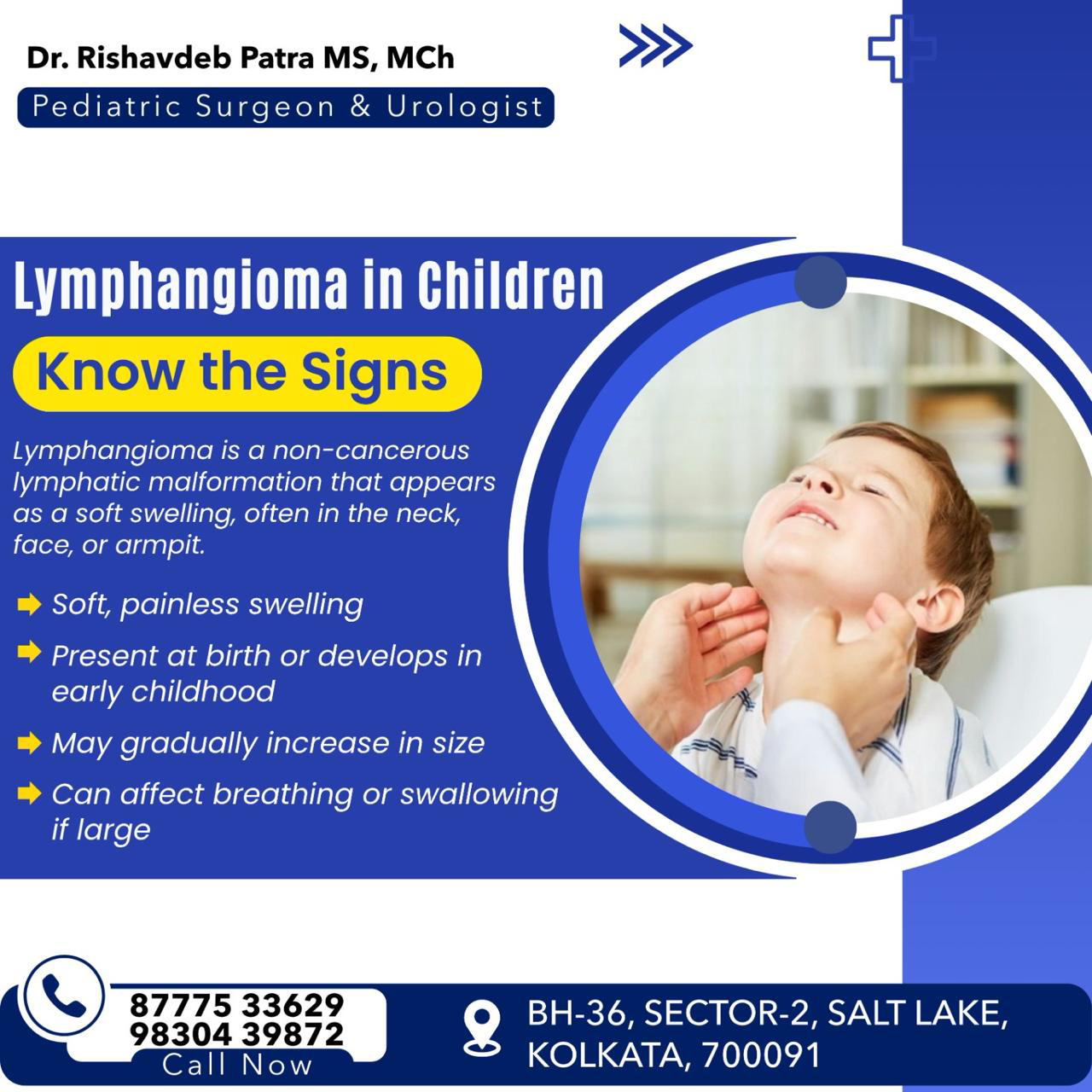 Lymphangioma Treatment in Children