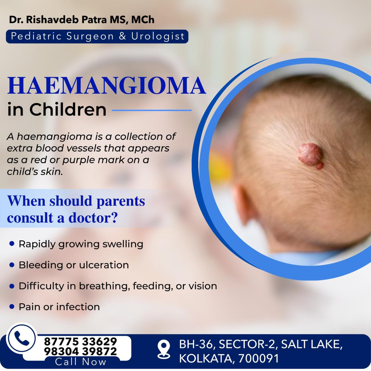 Haemangioma Treatment in Children